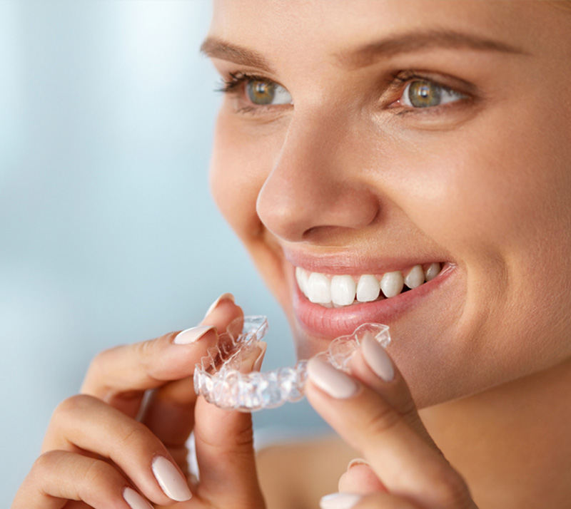 invisalign in innisfil